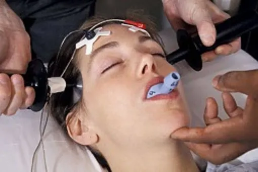 leczenie depresji psychotycznej, terapia skojarzona, elektrowstrząsy