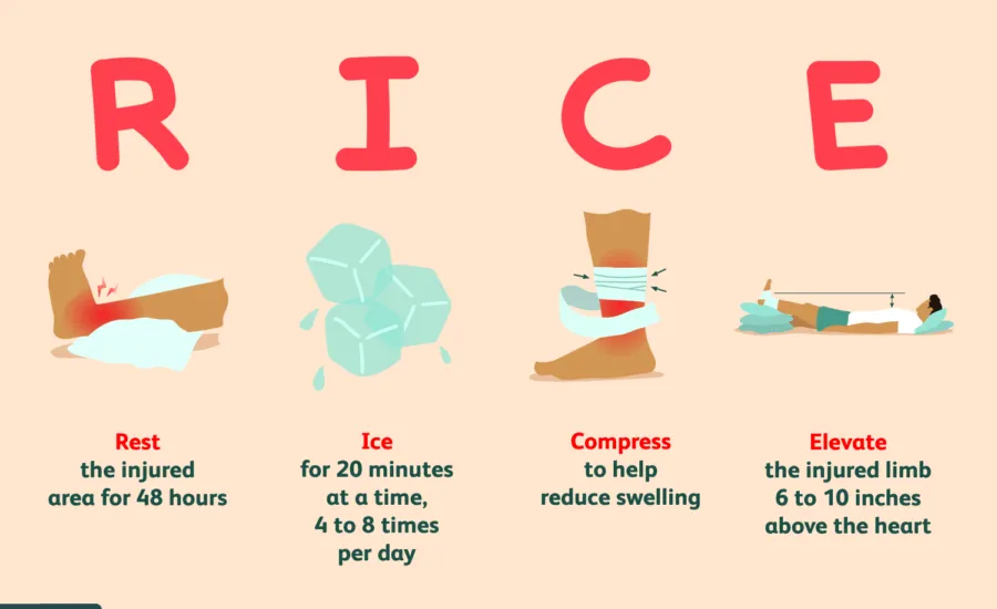 protokół RICE PRICE skręcenie kostki