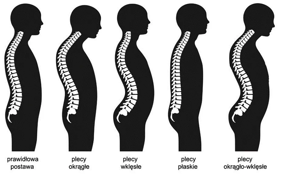 osoba z dobrą postawą i silnym kręgosłłupem