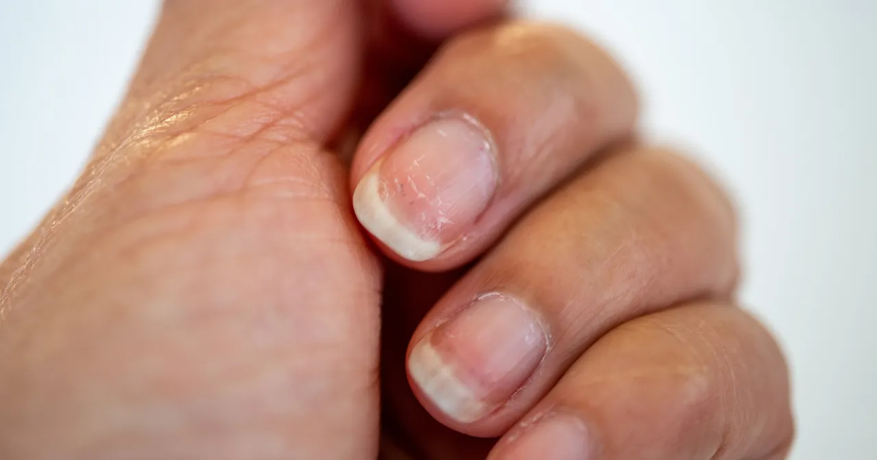 Kobieta zmęczona, blada, z sińcami pod oczami