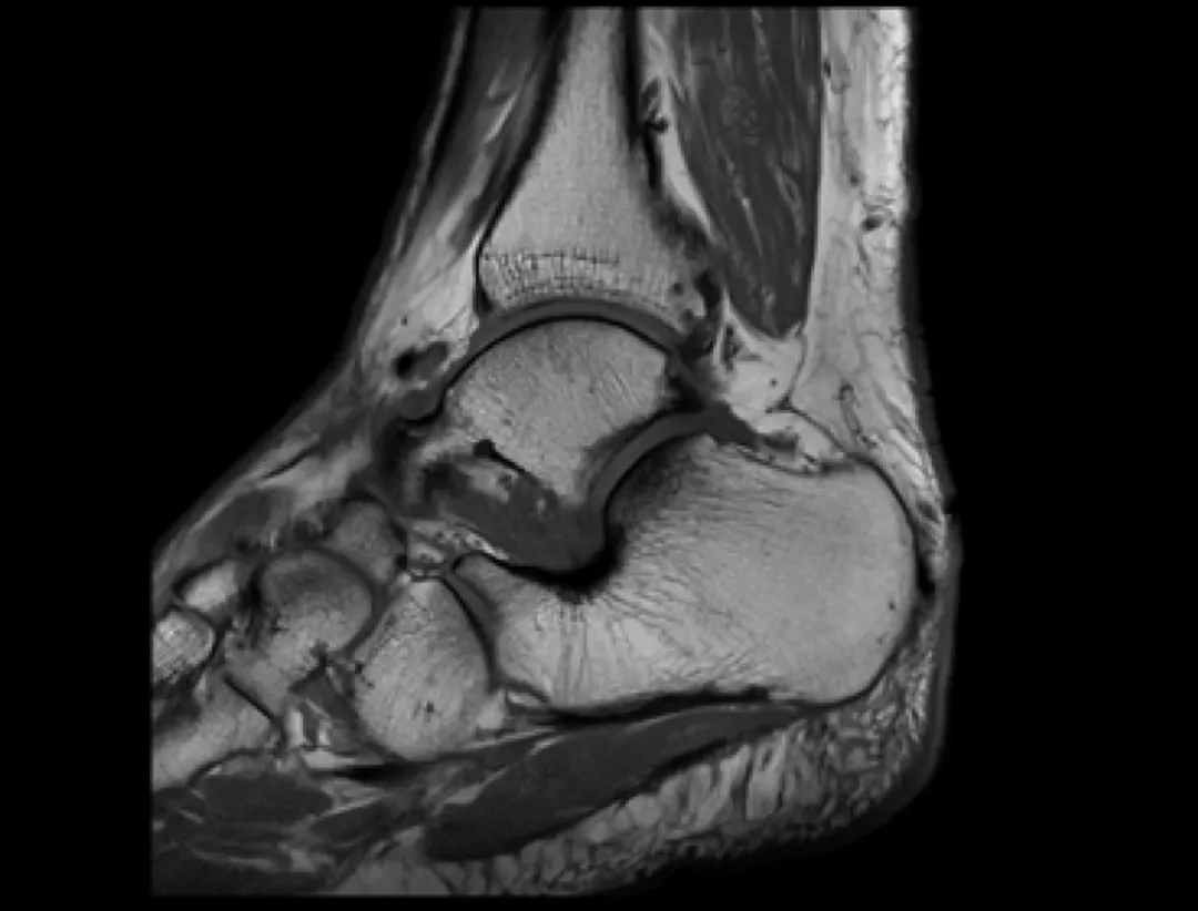 diagnostyka urazu stopy RTG rezonans