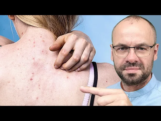 Objawy chor&oacute;b wątroby