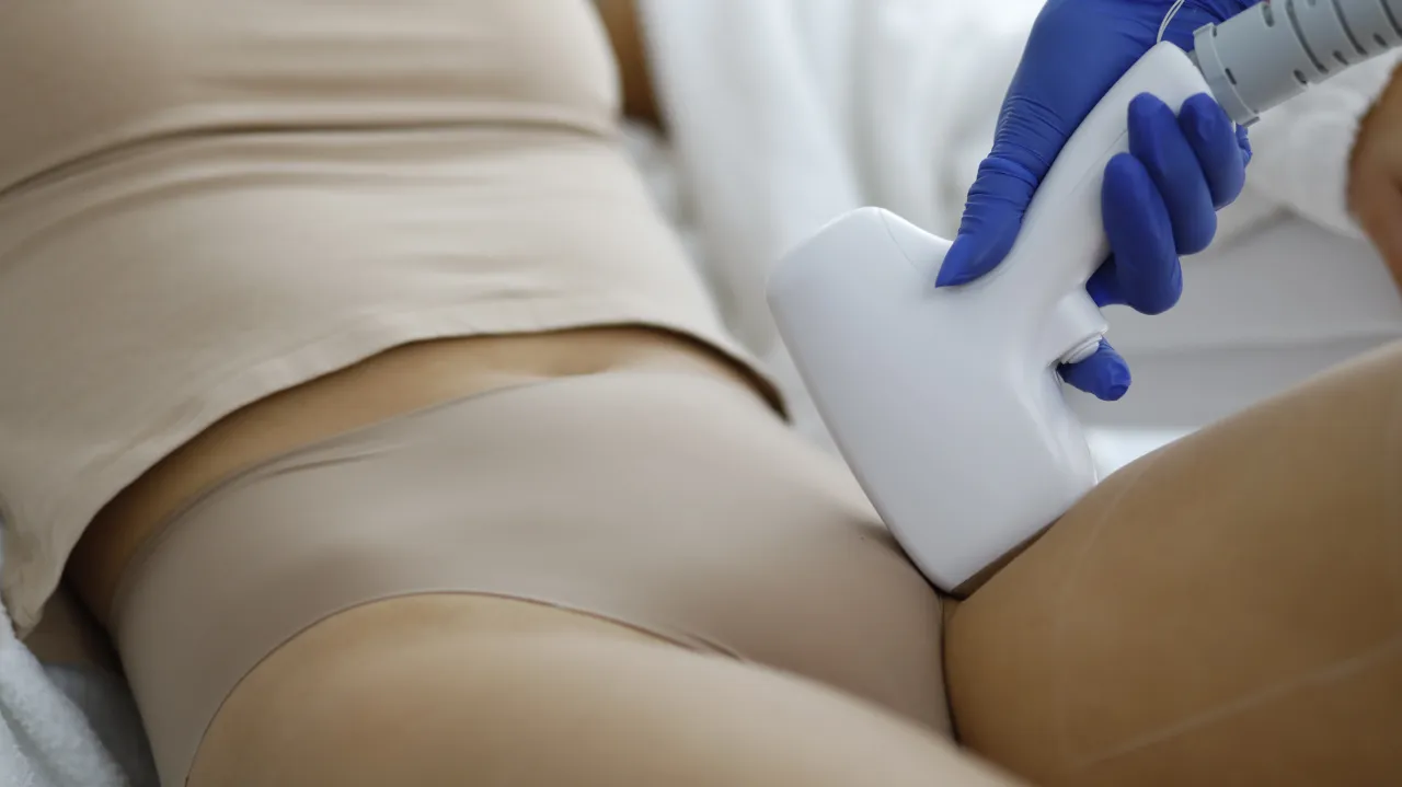 Zabieg depilacji laserowej bikini głębokie. Dłoń w niebieskiej rękawiczce trzyma głowicę lasera, zbliżając ją do skóry.