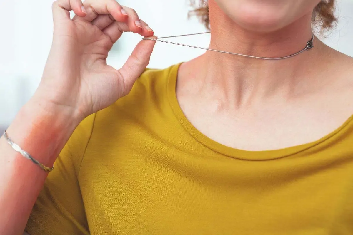 Alergia na biżuterię z białego złota