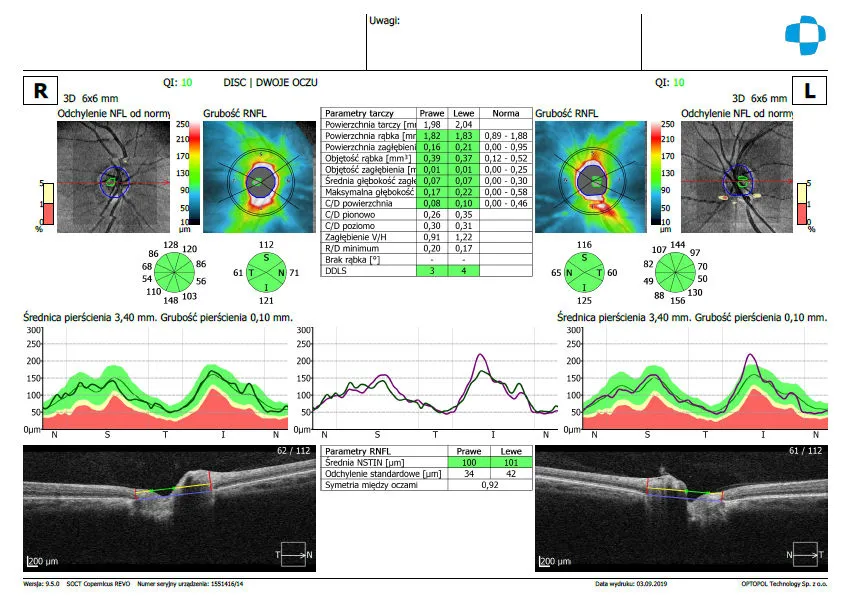 wynik badania oct interpretacja