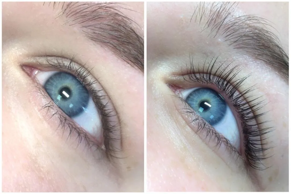 por&oacute;wnanie botoks lifting laminacja rzęs