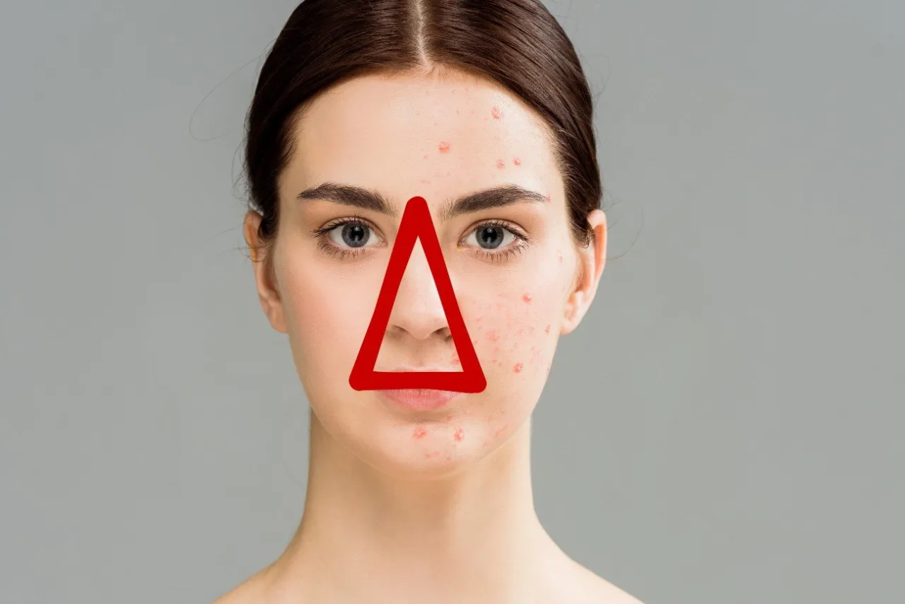 Mapa trójkąta śmierci na twarzy z zaznaczeniem obszaru