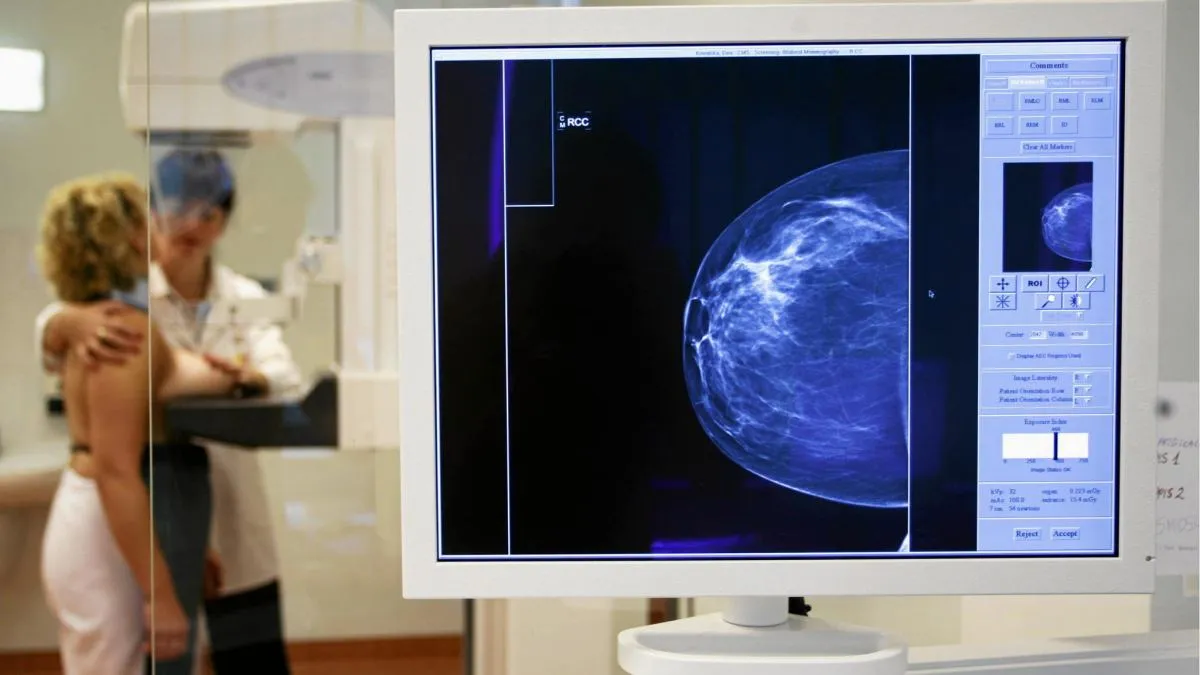 Zdjęcie Mammografia na NFZ od jakiego wieku? Sprawdź, czy jesteś uprawniona