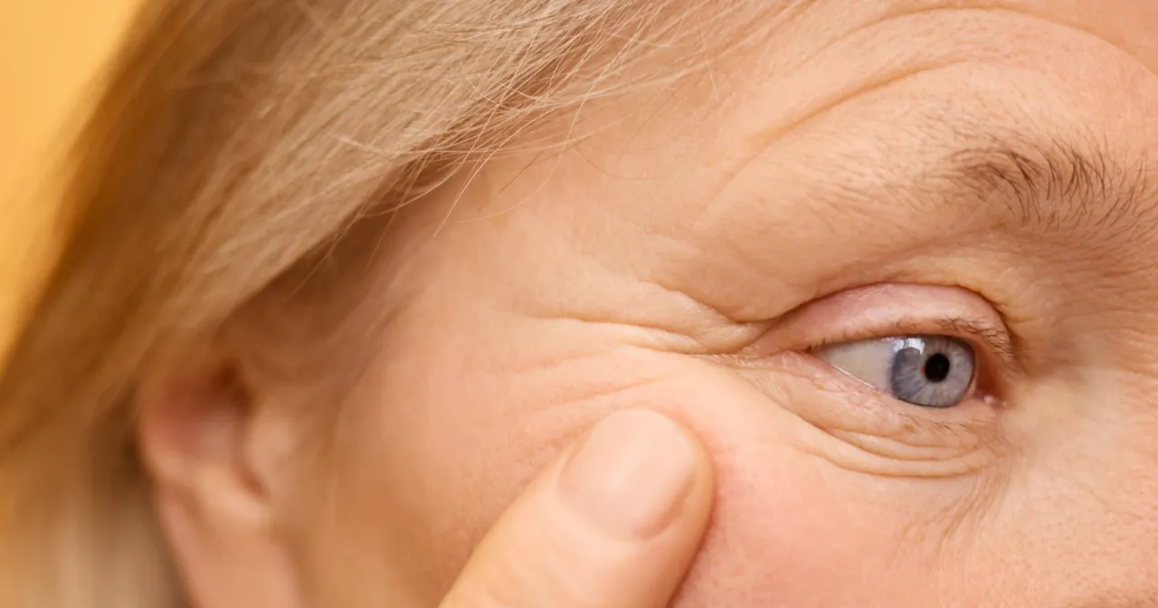 Zbliżenie na oko starszej kobiety z widocznymi zmarszczkami. Dowiedz się, czego nie robic po kwasie hialuronowym, by zachować efekt.