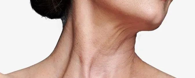 pielęgnacja szyi po 50