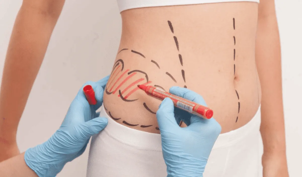 Rodzaje znieczulenia w liposukcji