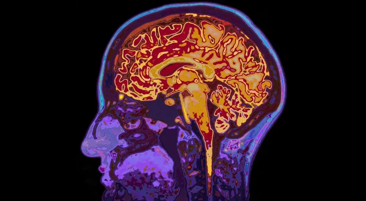 m&oacute;zg podczas śmierci aktywność