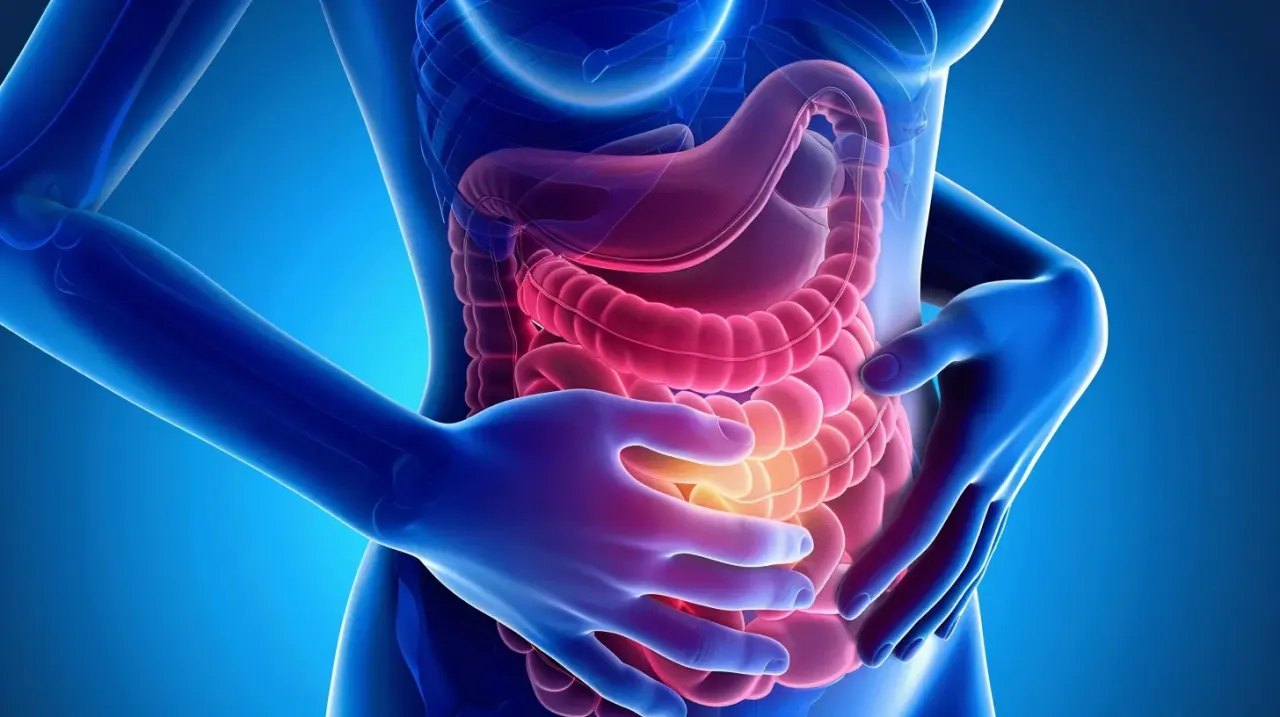 skręt jelit mechanizm