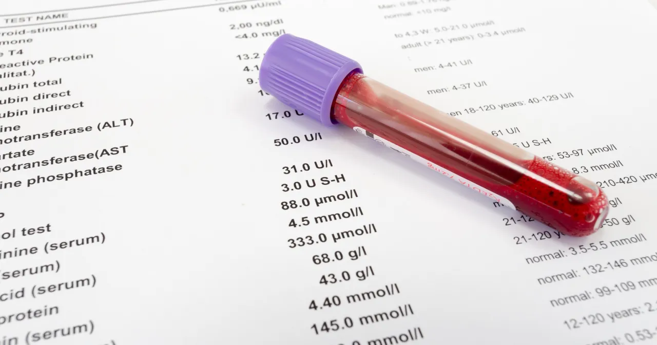 Pobieranie krwi w laboratorium