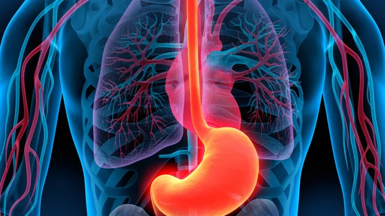 Uszkodzenie błony śluzowej żołądka