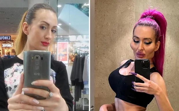 kobieta zaniepokojona po zabiegu medycyny estetycznej