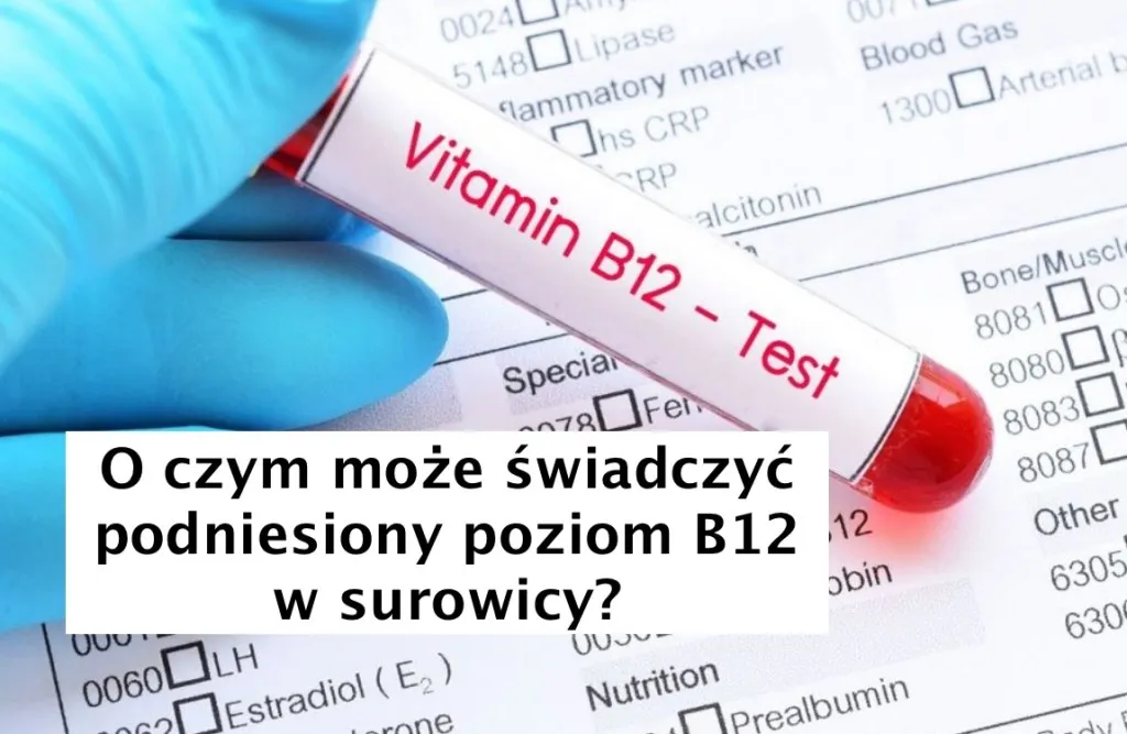 Zdjęcie Podwyższony poziom B12: jakie mogą być poważne konsekwencje zdrowotne?