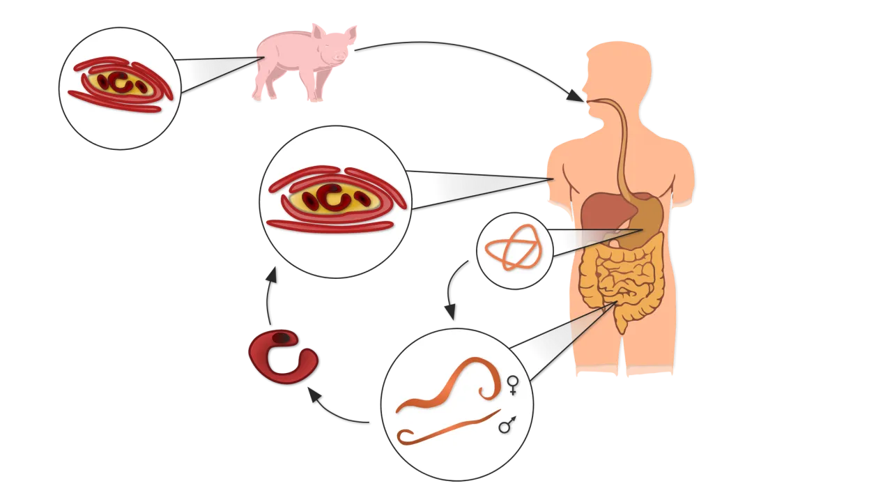 cykl życia włośnia trichinella objawy