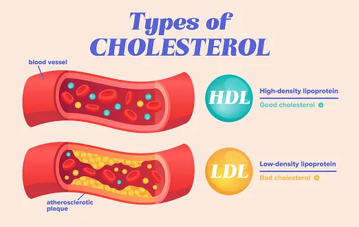 Cholesterol LDL a HDL porównanie grafika