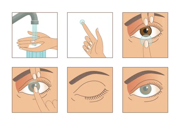 Zakładanie soczewek kontaktowych krok po kroku ilustracja