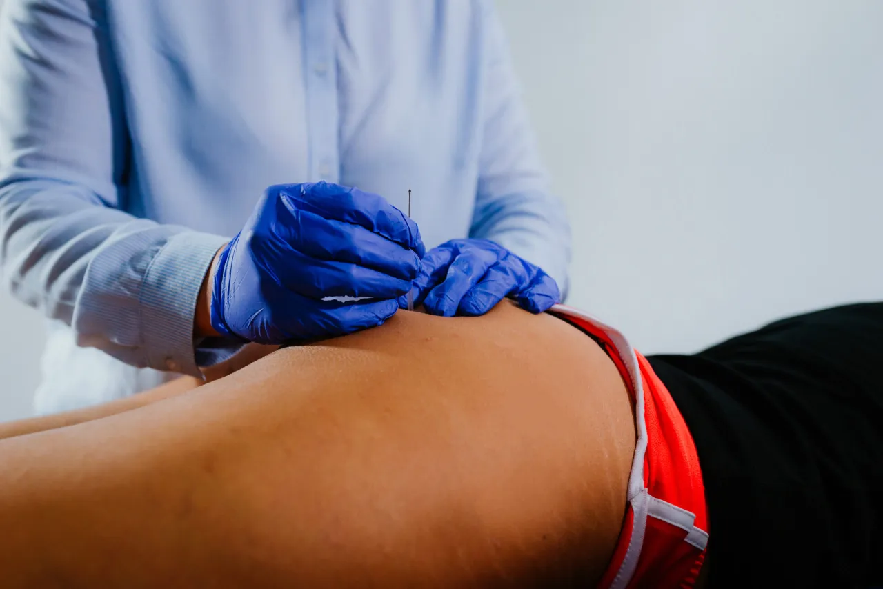 kinesiotaping na plecach, suche igłowanie, terapia manualna