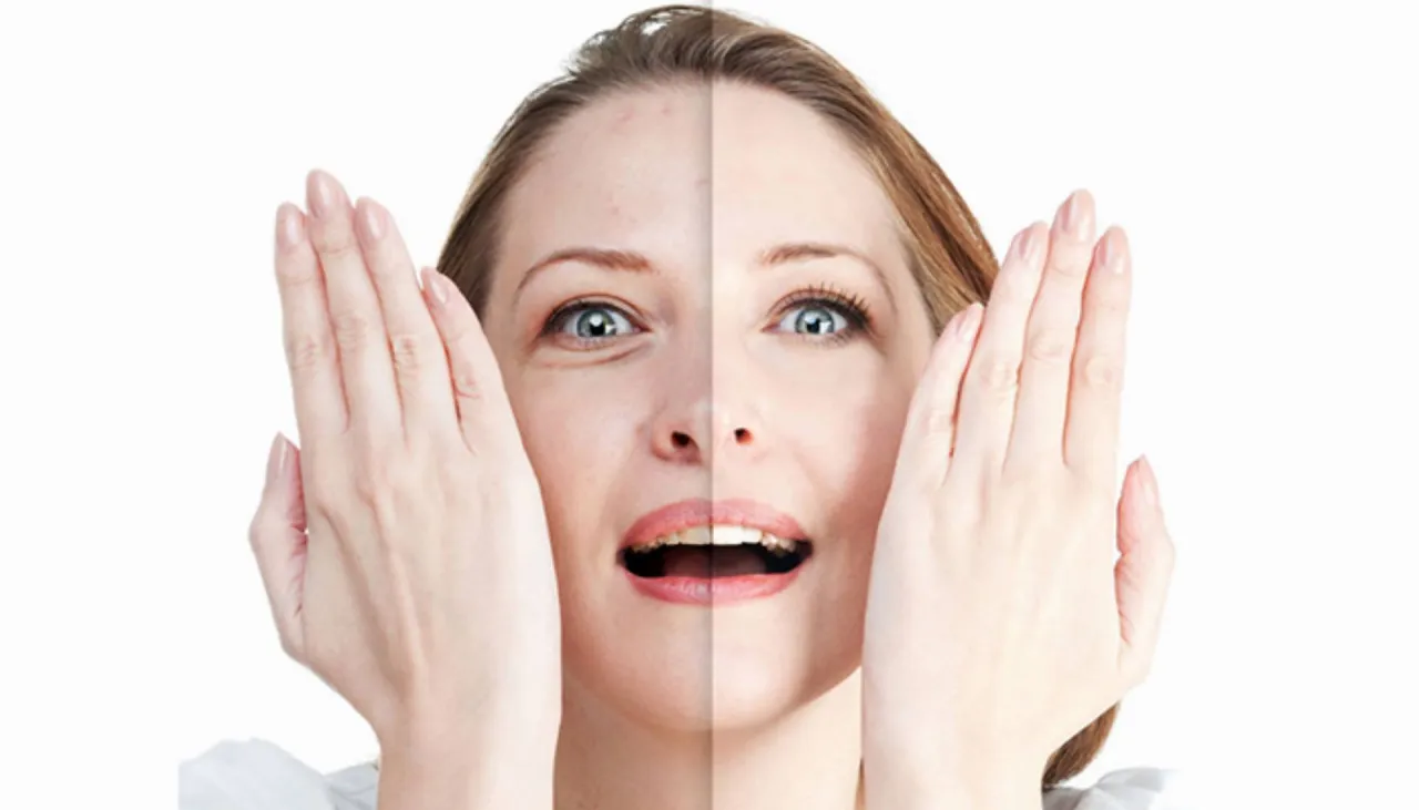 Ziemista cera jak wygląda