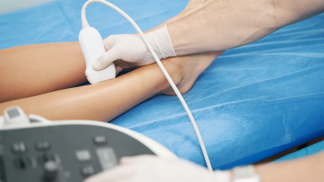 USG Doppler żył kończyn dolnych