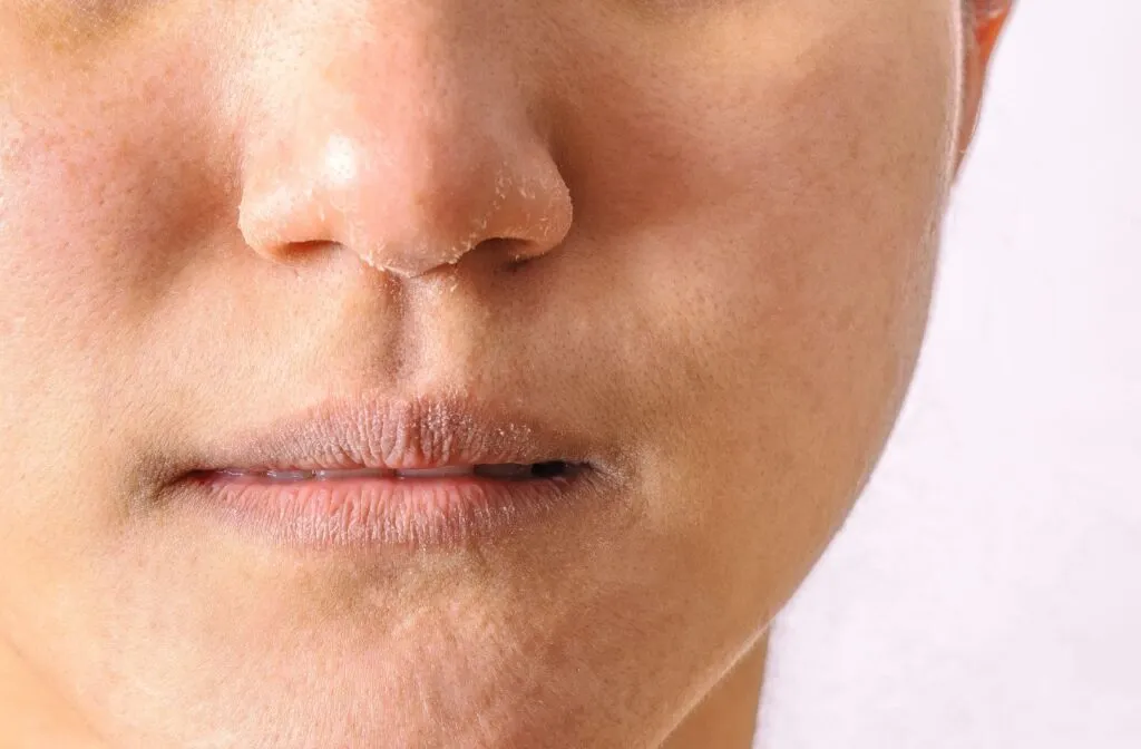 Zdjęcie Niedobór magnezu objawy skórne: jak rozpoznać i leczyć problemy