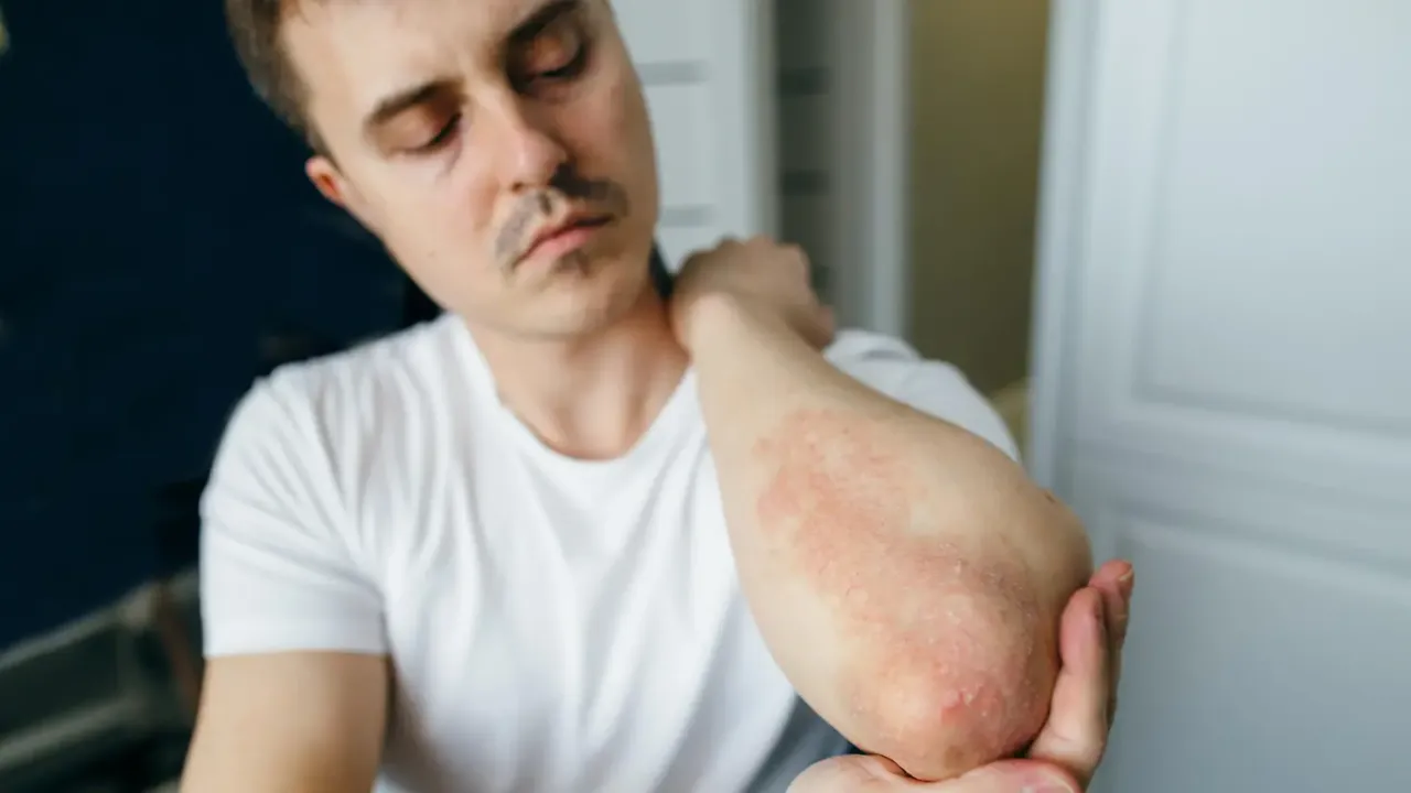 Zdjęcie Allergie Parfum Symptome: So erkennen Sie die gefährlichen Anzeichen