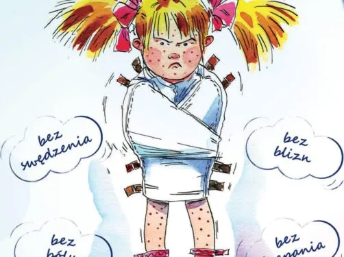 Zdjęcie Ospa w przedszkolu co robić: kluczowe kroki dla rodziców