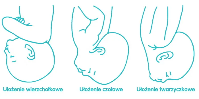 Zdjęcie Kiedy dziecko obraca się główką w dół? Sprawdź, co musisz wiedzieć