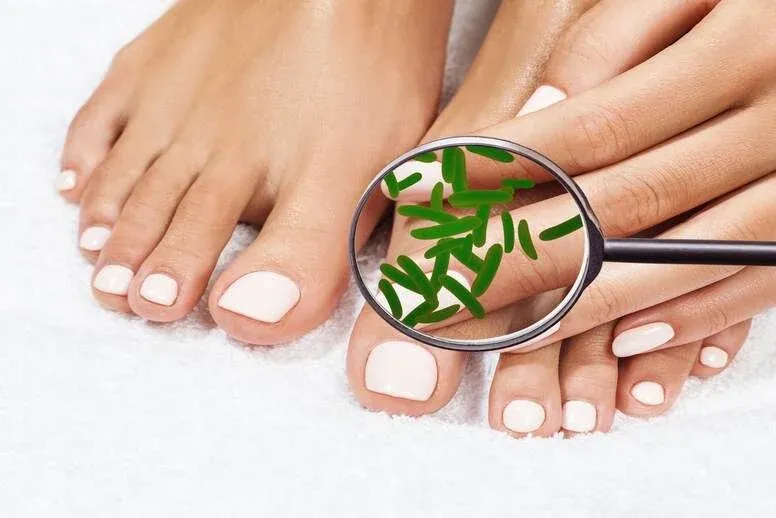 Zdjęcie Jak leczyć dziurę w paznokciu? Skuteczne metody i porady