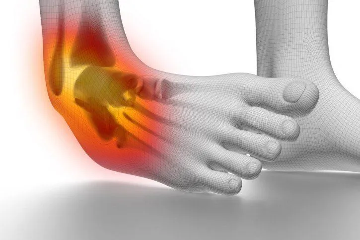 Pierwsza pomoc skręcenie śródstopia protokół PRICE POLICE