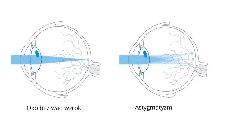 Astygmatyzm schemat widzenia
