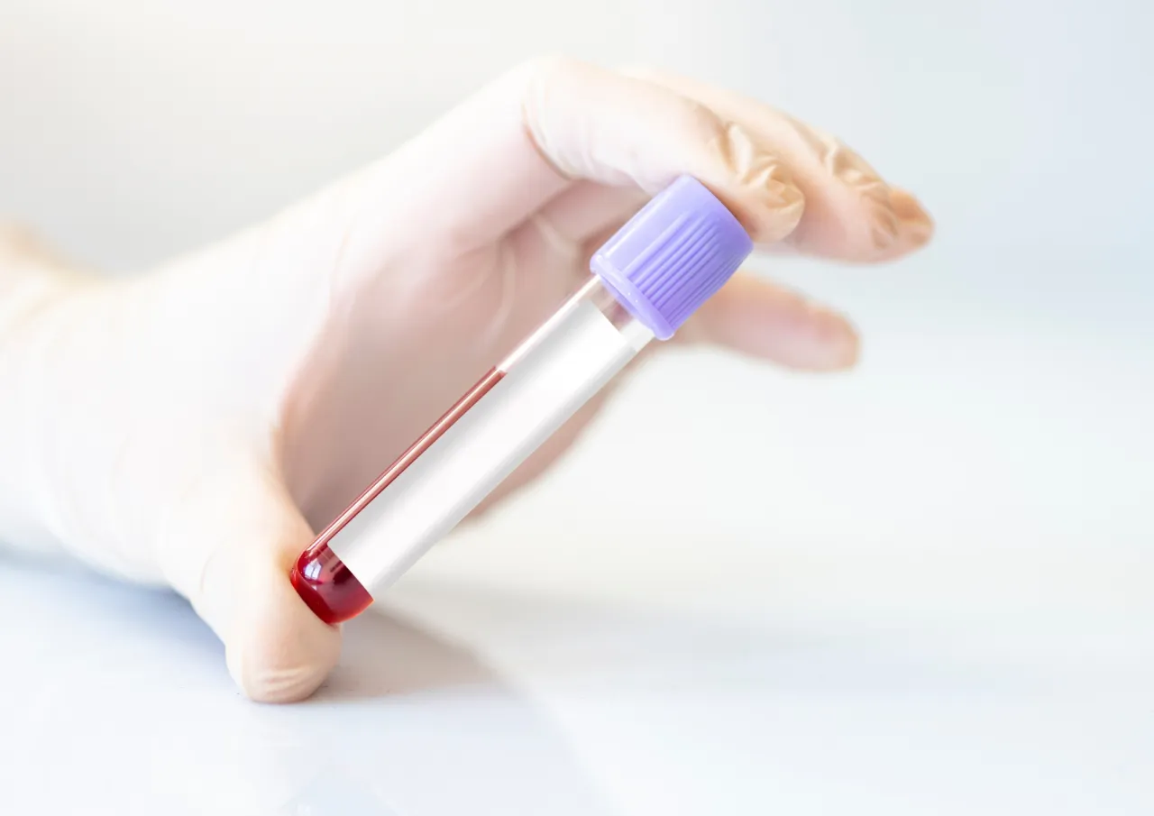 Wynik badania krwi wapń interpretacja