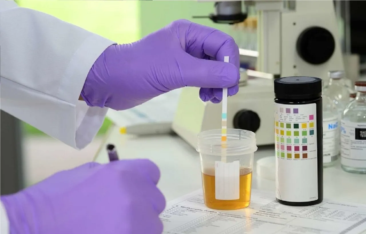 Rodzaje pr&oacute;bek do test&oacute;w na narkotyki (mocz, krew, włosy)