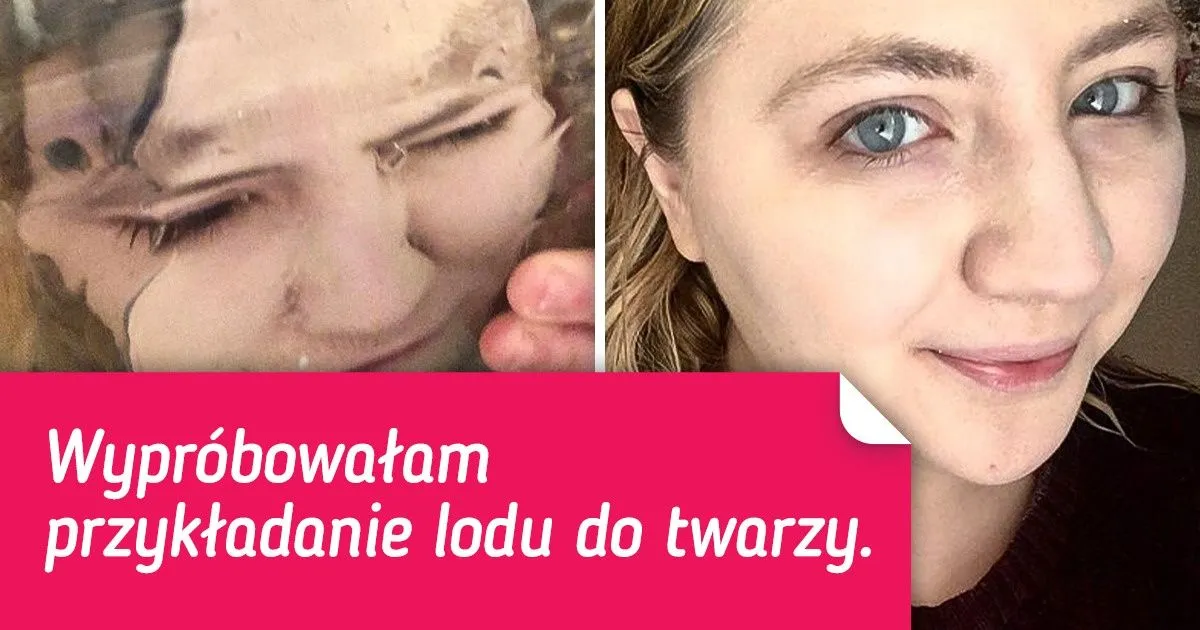 Skutki złego stosowania lodu na skórę