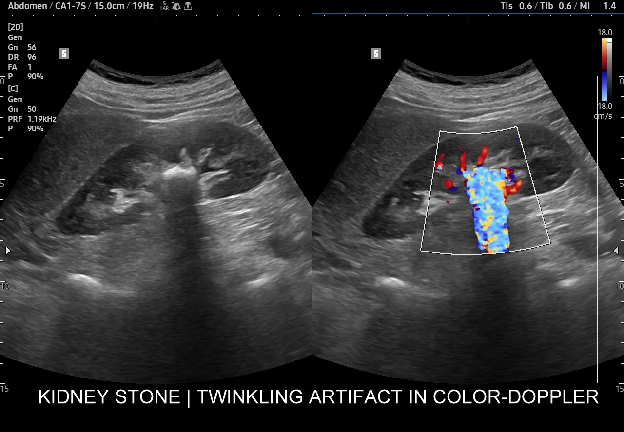 Dobowa zbiórka moczu