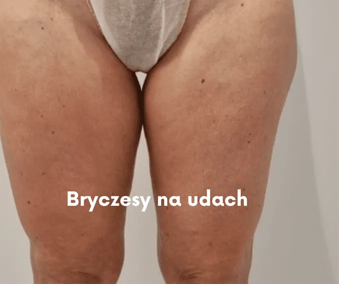 bryczesy na udach typ sylwetki gruszka