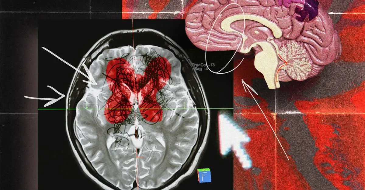 mózg fMRI religia medytacja aktywacja