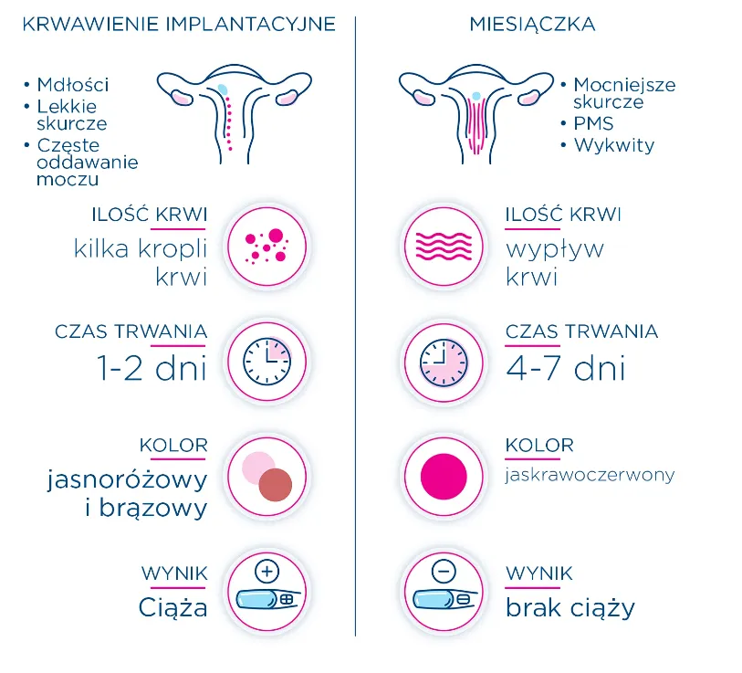 Plamienie implantacyjne vs miesiączka r&oacute;żnice
