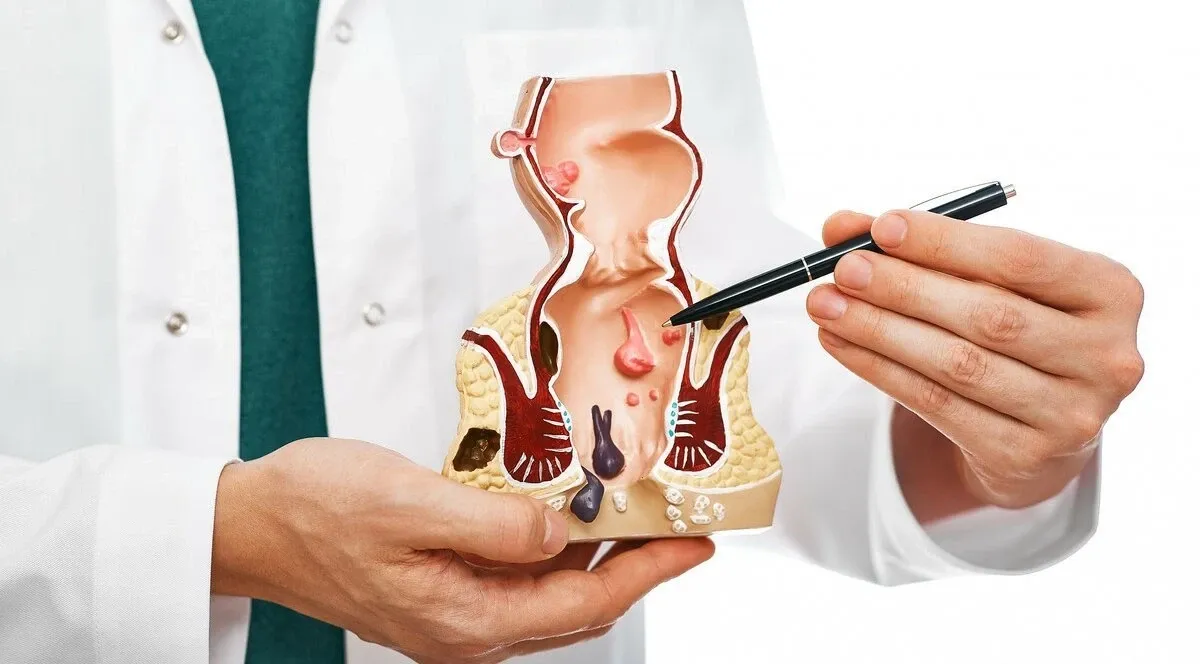 profilaktyka hemoroid&oacute;w dieta i ruch