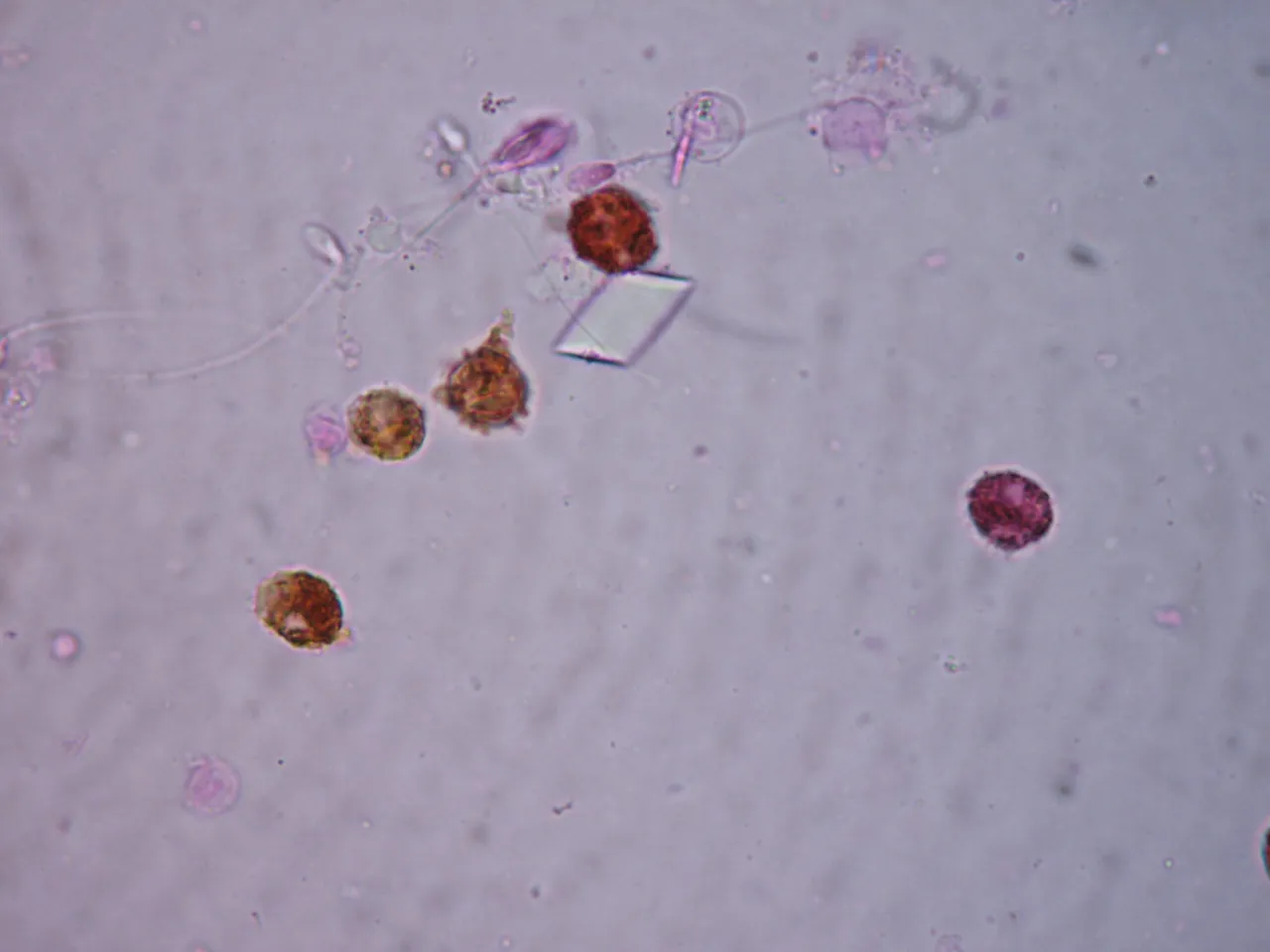 leukocyty pod mikroskopem