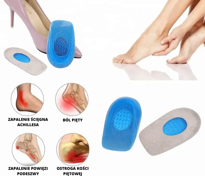 Maści i żele na zapalenie powięzi podeszwy