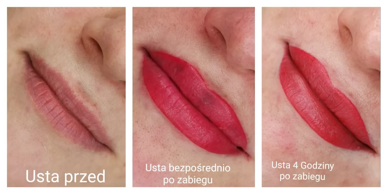 proces gojenia ust makijaż permanentny etapy