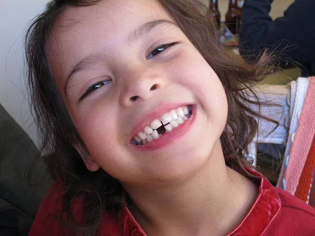 dziecko z ruszającym się zębem mlecznym