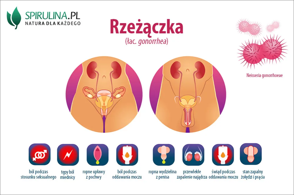 Zdjęcie Pierwsze objawy rzeżączki - lista symptomów, które powinny Cię zaniepokoić