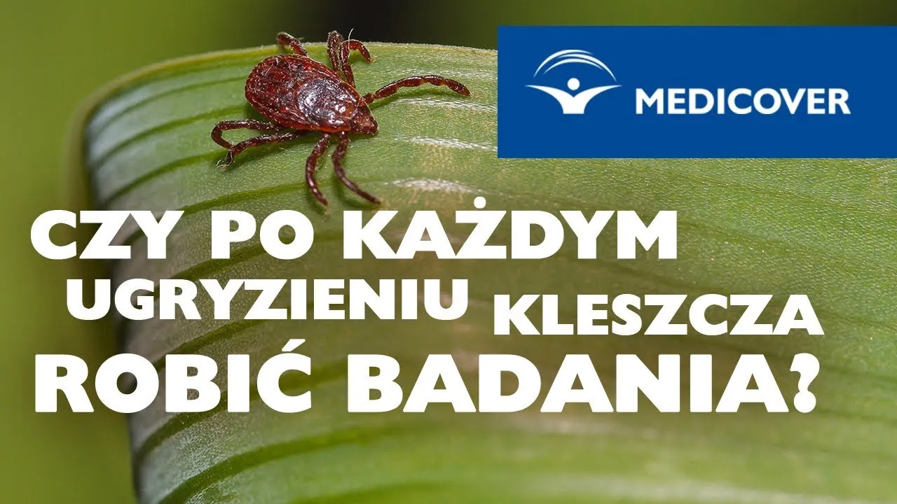 Zdjęcie Jakie badania wykonać po ugryzieniu kleszcza, by uniknąć groźnych chorób?