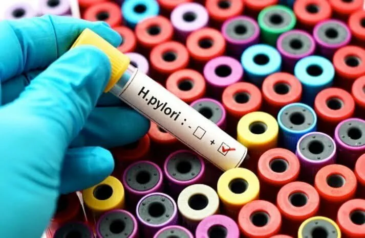Zdjęcie Czy NFZ refunduje badanie Helicobacter pylori z krwi? Sprawdź alternatywy