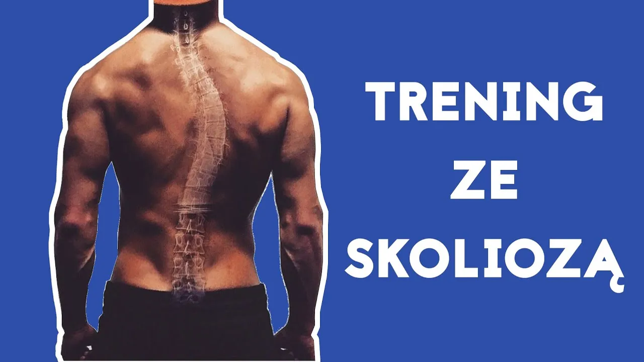 Ćwiczenia zakazane przy skoliozie